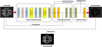 FFA-DMRI: A Network Based on Feature Fusion and Attention Mechanism for Brain MRI Denoising